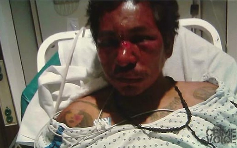 Man Gets Shot by Police, Fought With Them Nearly 2 Weeks Prior