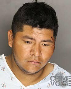 Omar Mendoza in a hospital gown for his booking photo