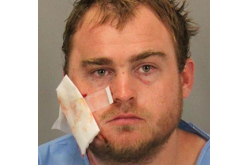 Illegal Fireworks mishap leads to arrest