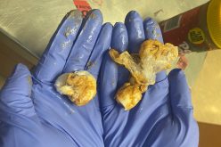 Lodi man allegedly tried to mail baggies of cocaine hidden in jar of peanut butter