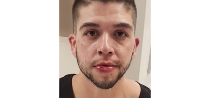 Police: Redding man arrested after allegedly brandishing knife, making threats